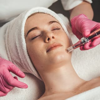 Dermapen en Madrid 1